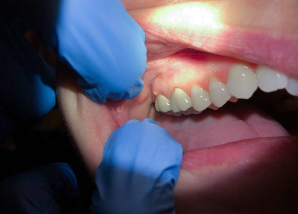Best Pediatric Emergency Dentist in Water Valley, MS